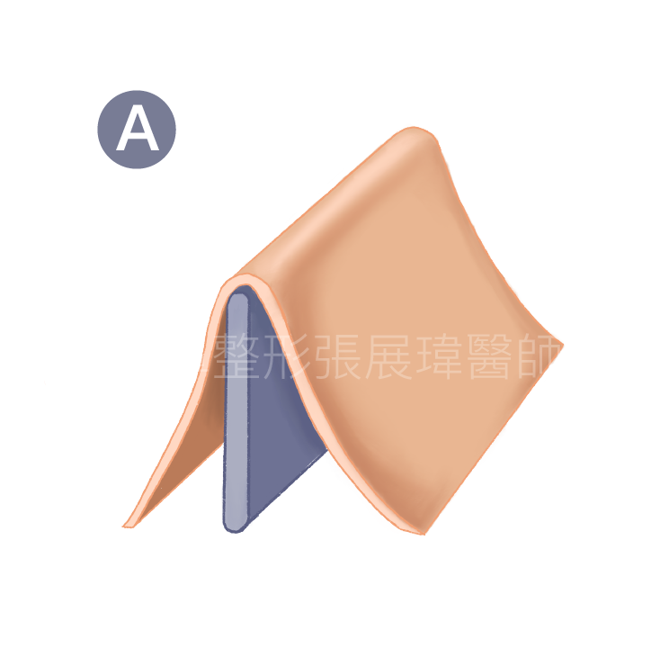鼻中隔彎曲矯正 – AR進階鼻美學時尚診所